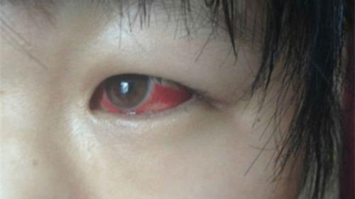 光觸媒除甲醛保護(hù)新裝修教室空氣，更保護(hù)孩子們