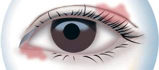 CBA***得分手發(fā)高燒吸氧0得分 教練：賓館房間新裝修，甲醛中毒導(dǎo)致的！