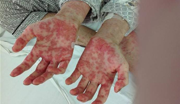 室內(nèi)甲醛檢測治理，你不得不需要了解的三點！