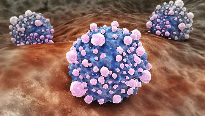 平時(shí)不注意甲醛超標(biāo)，50歲女子劇烈頭痛、惡心干嘔，一查已是癌癥晚期！