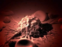 癌癥、白血病越來越多，是因為時代在進步而導(dǎo)致的嗎？