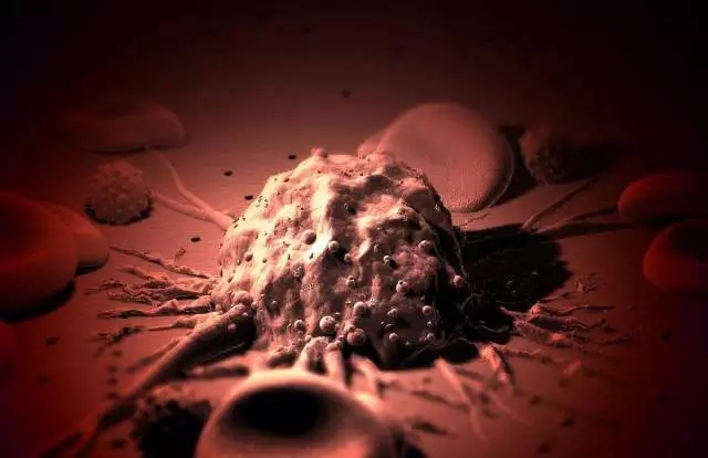 癌癥、白血病越來越多，是因為時代在進步而導(dǎo)致的嗎？